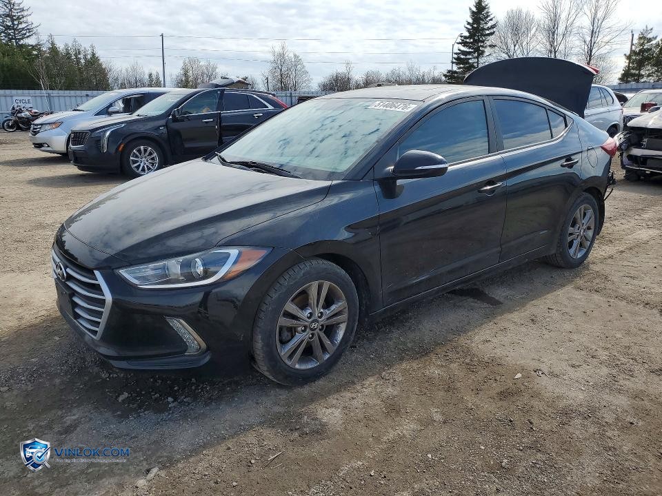 2018 HYUNDAI ELANTRA SEL – Lot 51406476 auction photo