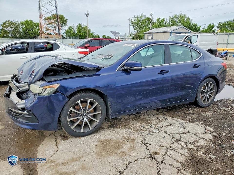 2015 ACURA TLX TECH – Lot 53054786 auction photo
